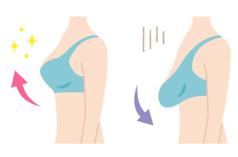 fix sagging breast naturally